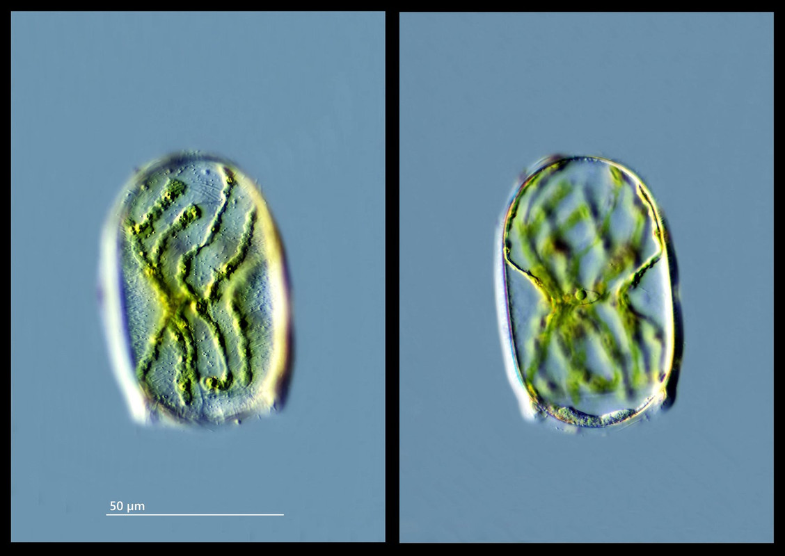 Spirogyra 35 (ev) sp degeneriert Große Einzelzelle DIK 50 Komp 2