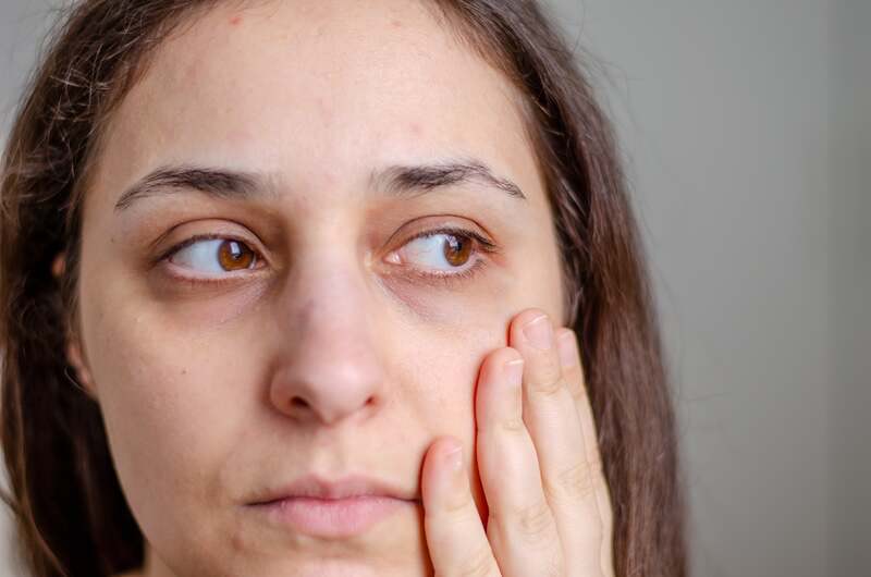 Marques de fatigue et cernes - Résultats soin Jouvence