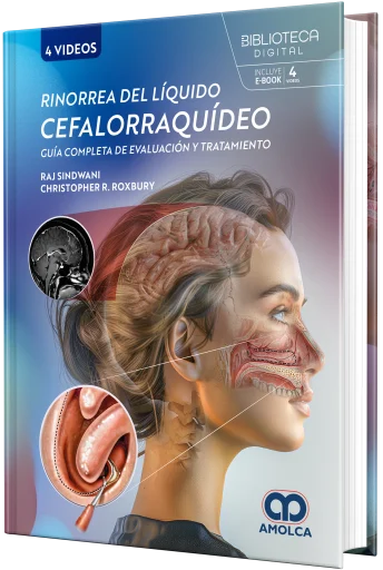 Portada de Rinorrea de líquido cefalorraquídeo: Guía completa de evaluación y tratamiento