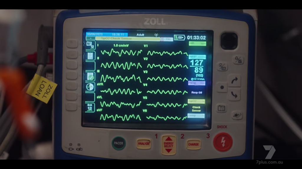 [Image: qqgs5oy2yk65.png]