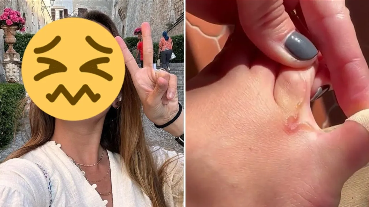 Famosa en crisis de salud, revela que tiene gusanos dentro de su cuerpo