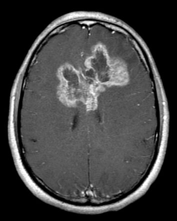 Oncology question 10 image
