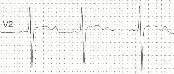 Psychiatry question 3 image