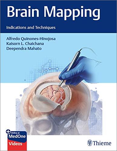 Brain Mapping: Indications and Techniques