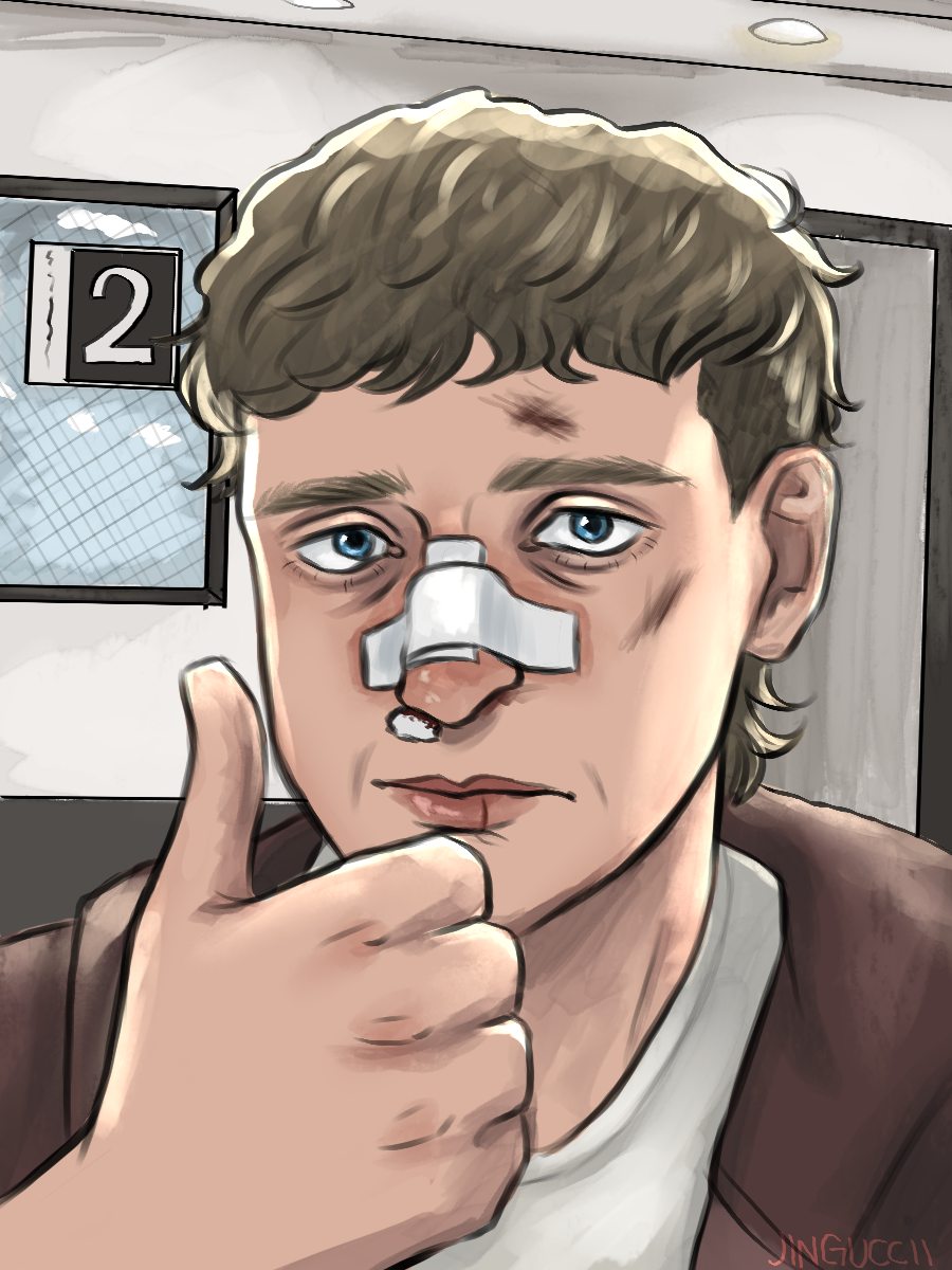 Dennis giving a thumbs up with a broken nose