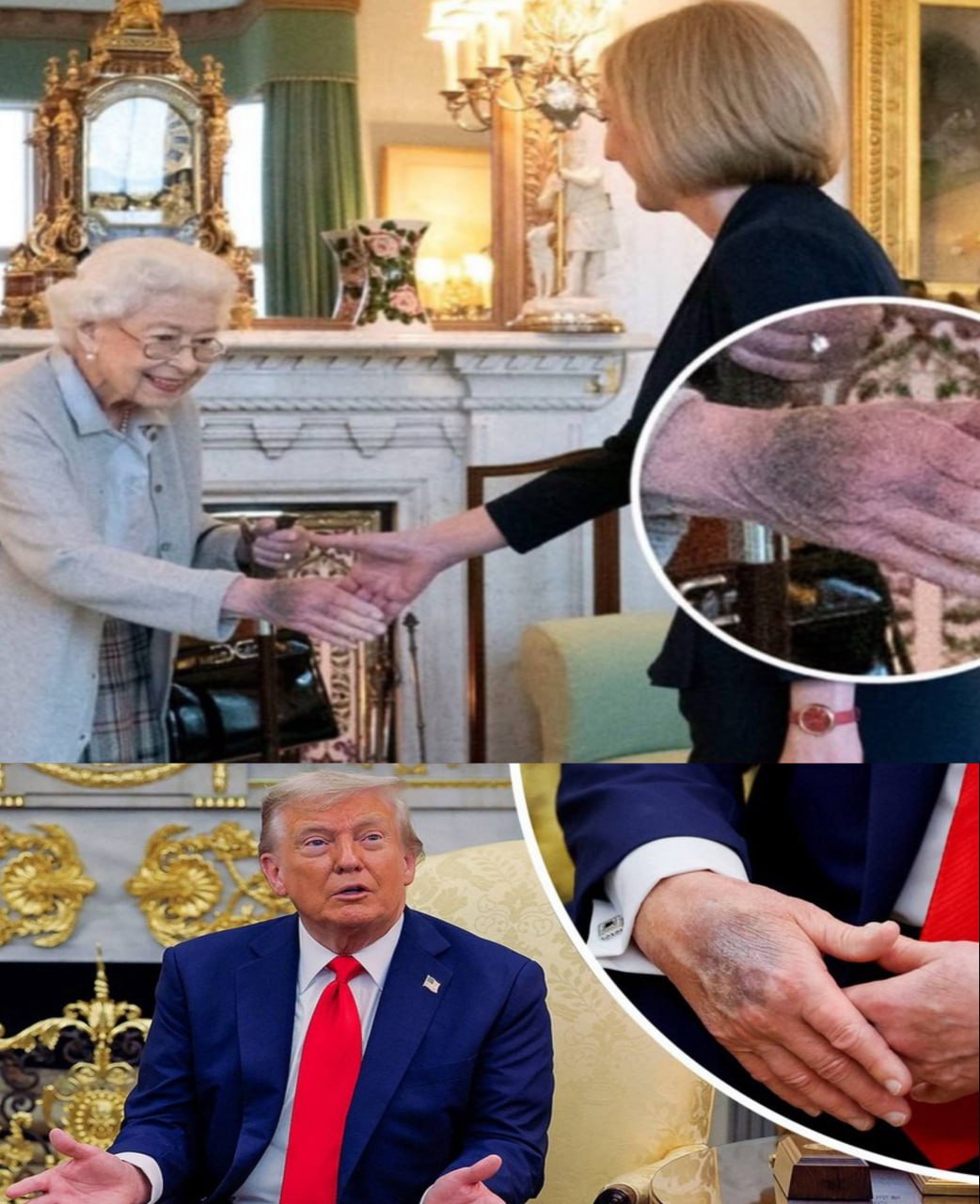 На руке Трампа заметили синяк, как у Елизаветы II за несколько дней до смерти