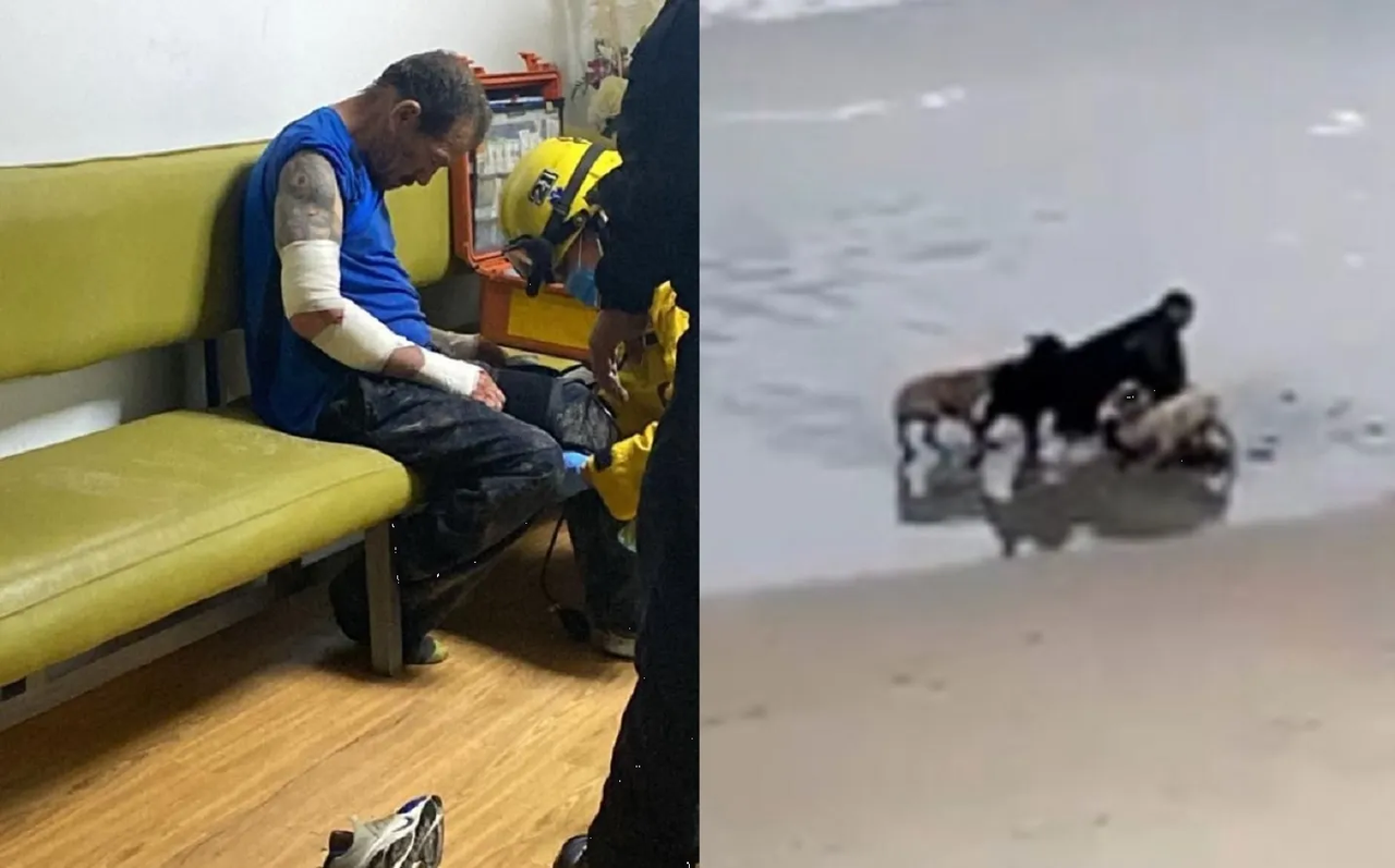 Hombre se defiende de brutal ataque de perros en Tijuana y se hace viral
