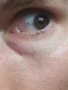 eye-3