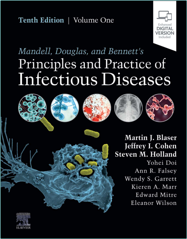 [Image: ux6tk2zw1gv8.png]