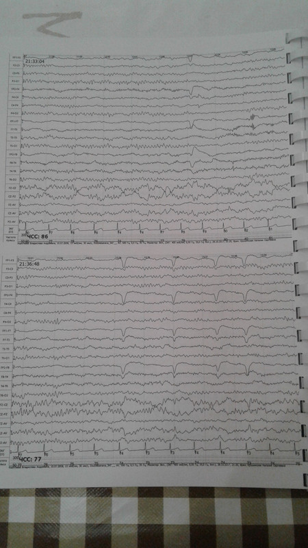 1510520739585-1841790386