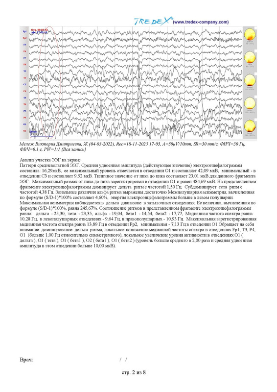 BD93960B-0A3D-4C16-9AF5-8ED737E3E432