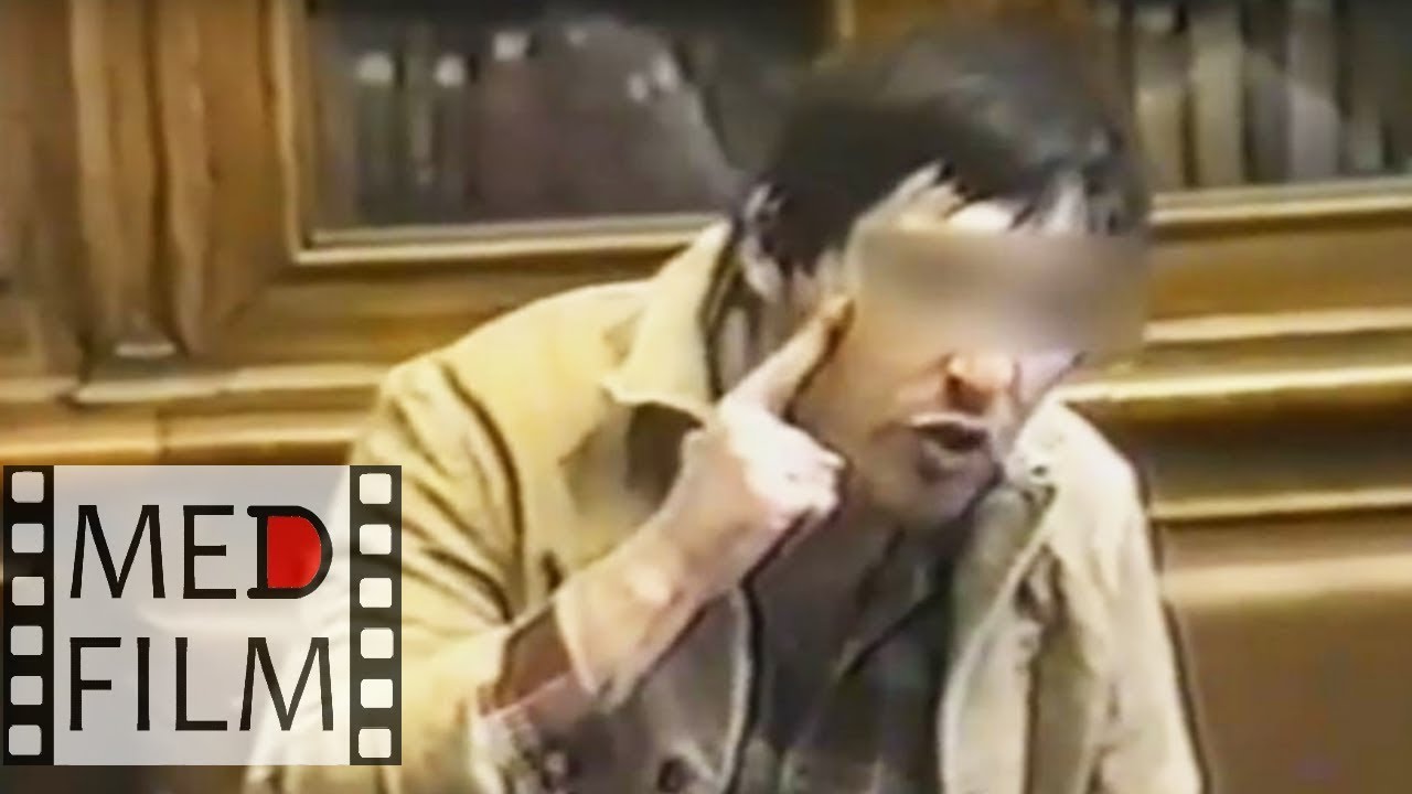 дебильность