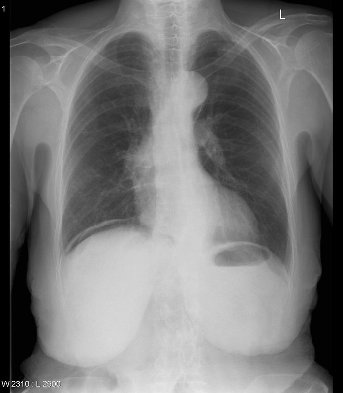 Gastroenterology question 8 image