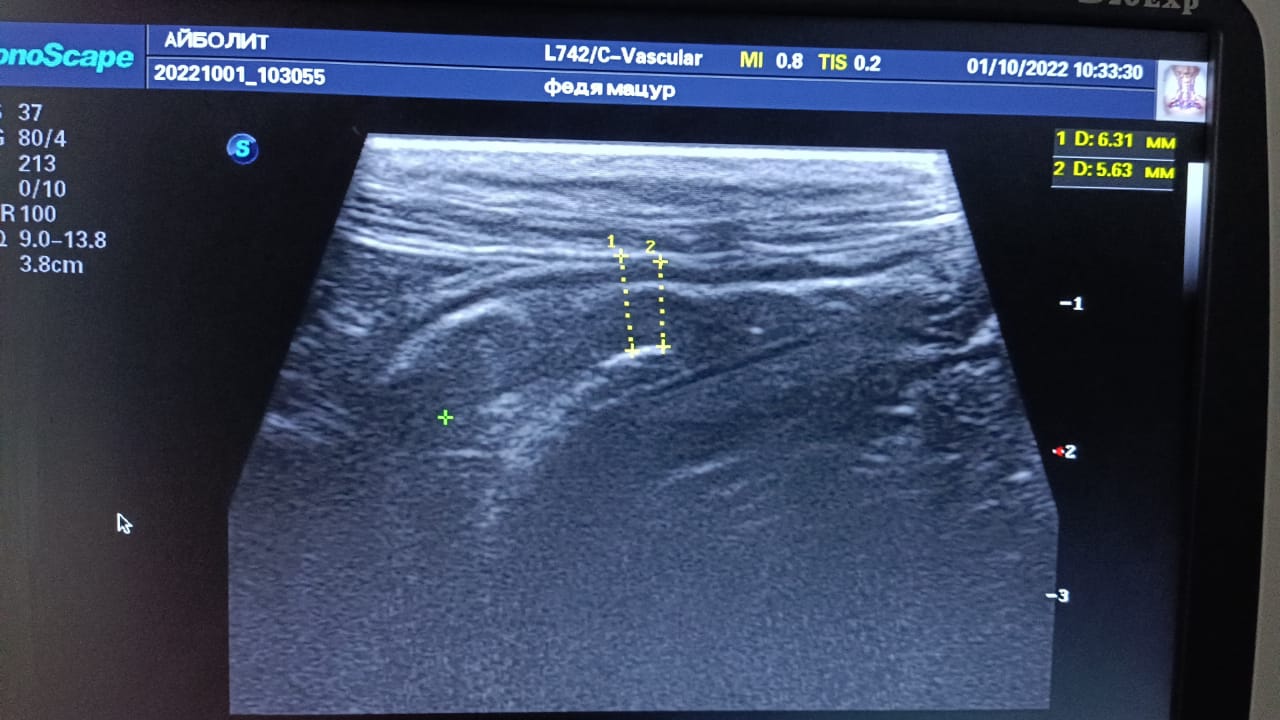 8A3F7BFE-B3F6-44D7-B6E5-15EF6F616FE1