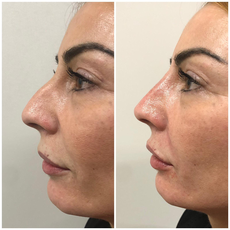 13-57-53-PHOTO-2019-03-12-13-03-06