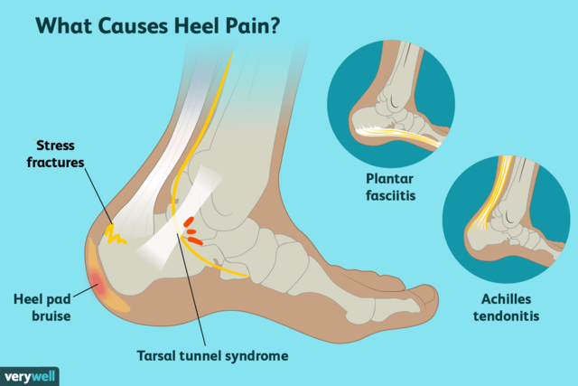 heelpainfinal-01-5c86a48246e0fb00014319ff-2.png