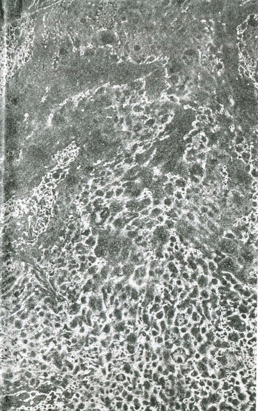 p0003