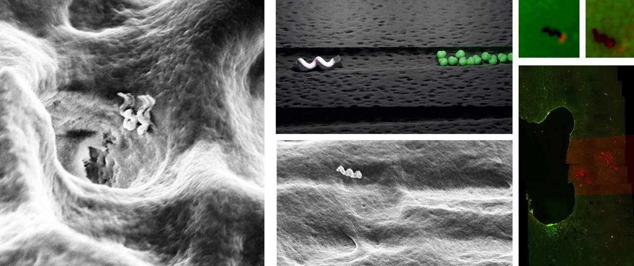 Pulizia denti a fondo: Nanobot in grado di uccidere i batteri all'interno con il calore