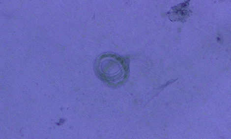 nematodos-2-zpsb4n64kdi.jpg