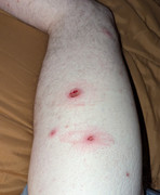 PXL 20251206 045609890