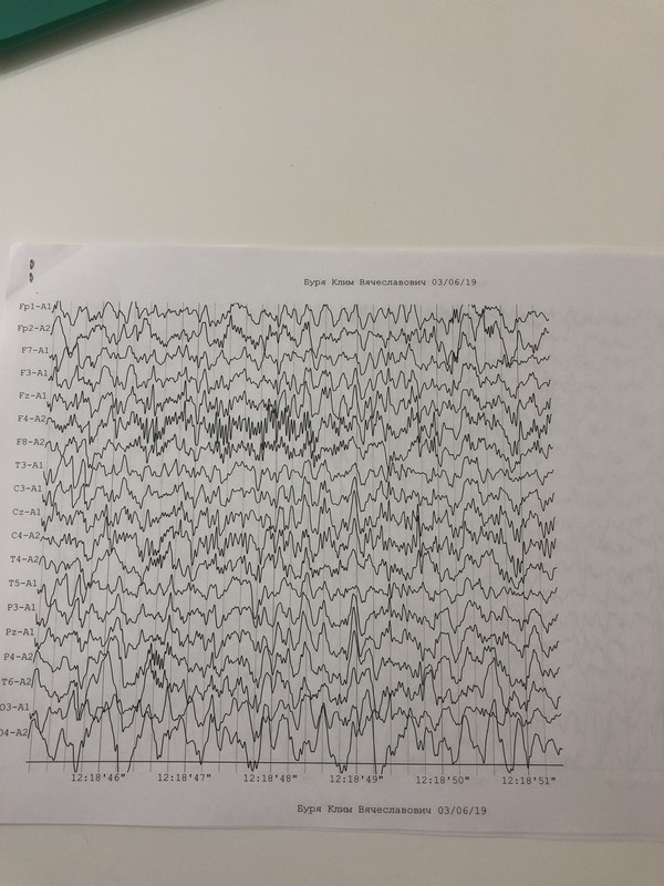 865D58C8-F0BB-49EE-A1EE-1B6DD5AE161D