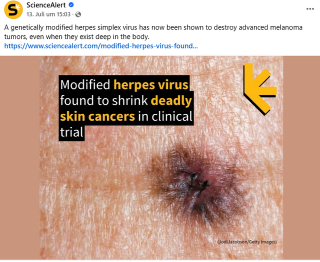 Herpes Virus gegen schwarzen Hautkrebs