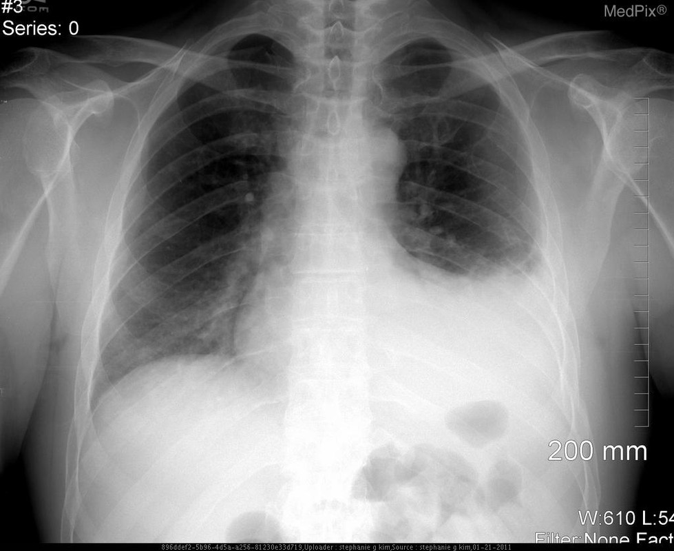 Pulmonology question 6 image