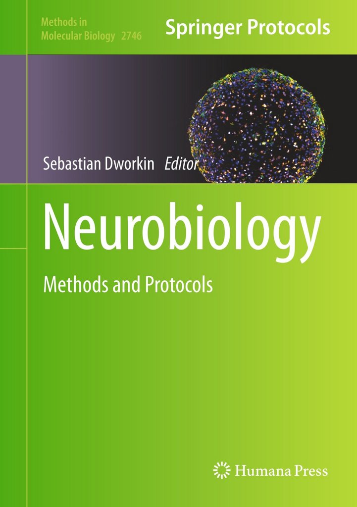 [Image: 96pmyz0qn6ju.jpg]