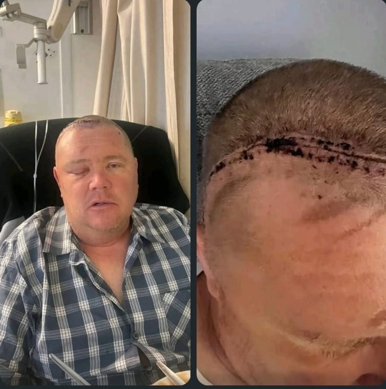 James L. before and after