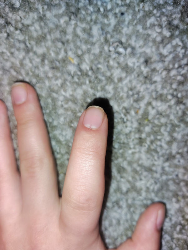 IMG_20250528_212212102_AE