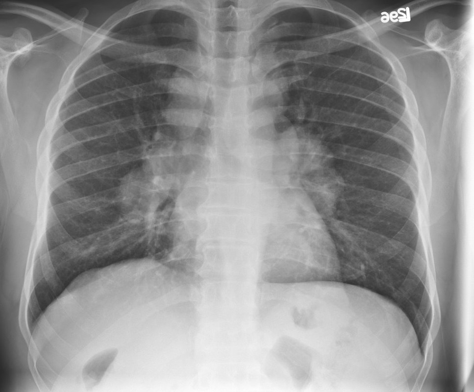 Pulmonology question 4 image