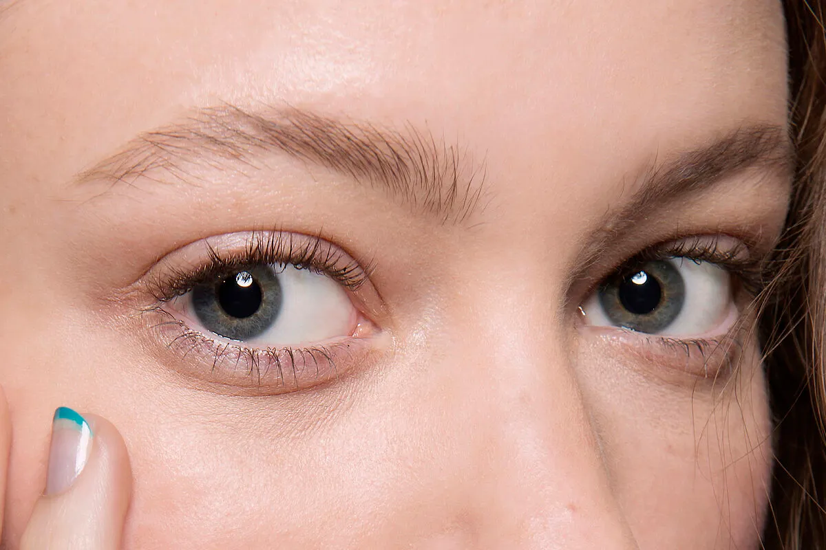 ¿Cuál es el remedio casero para eliminar las ojeras?