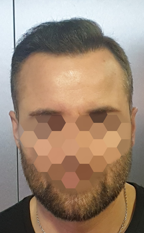 Point Blur_Dec082019_163435