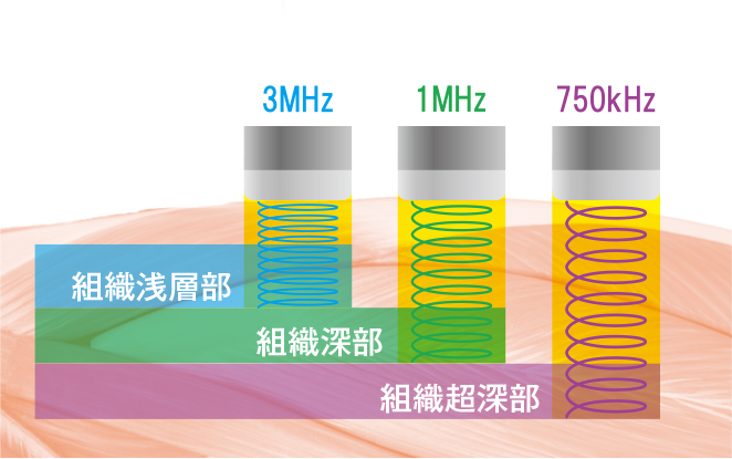 周波数イメージ