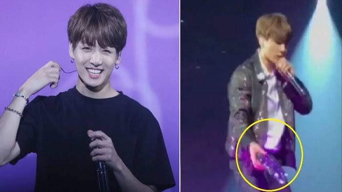 Jungkook BTS terluka