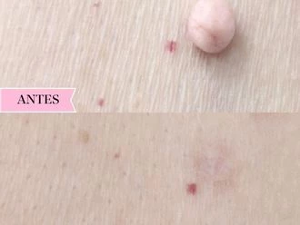 Antes y Después 2