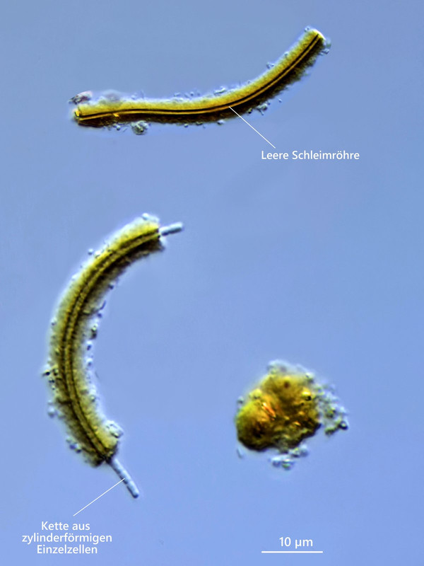 Bakterien 80 Leptothrix ochracea Ocker-Bakterium Zellen und leere Hülle DIK 100 Komp 2