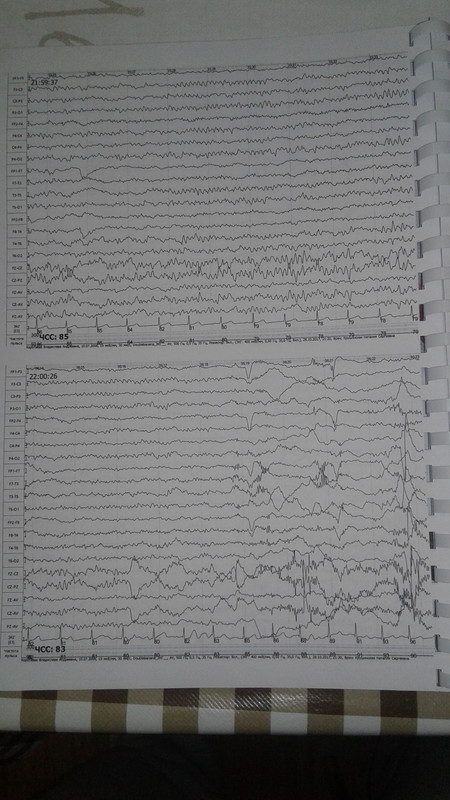 1510522519406574834421