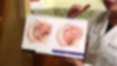 How to Fix a Prolapsed Bladder Without Surgery: Comprehensive Guide to Natural Remedies and Lifestyle Changes
