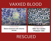 ! ! 00 Rescues Vaxxed Blood