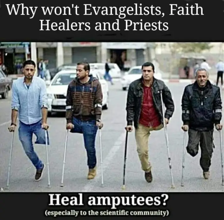 [Image: Amput.webp]