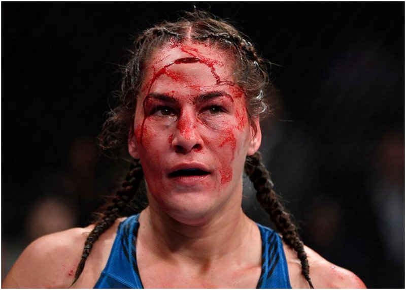 Джесика Ай показа шевовете на челото след UFC 264