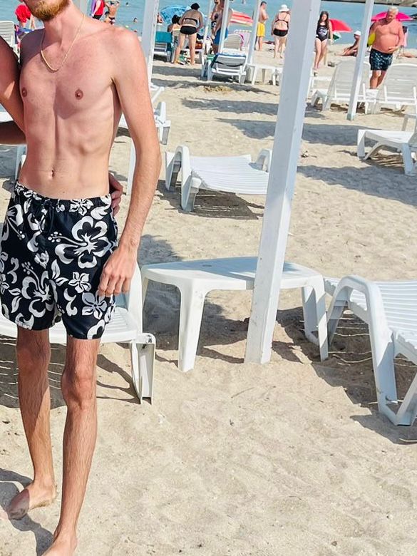 Alex în perioada de anxietate severă