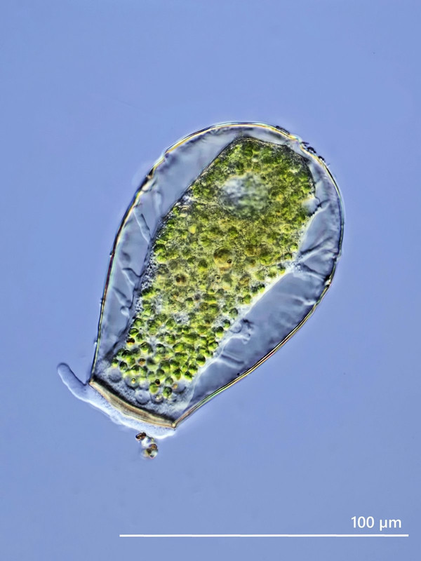 Hyalosphenia 05 papilio Glaskeil-Amöbe DIK 50 Faistenau Moor