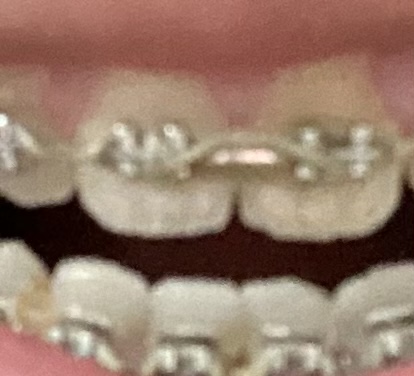 A702296D-5E58-4EFC-893D-4A9D89F8A0E7