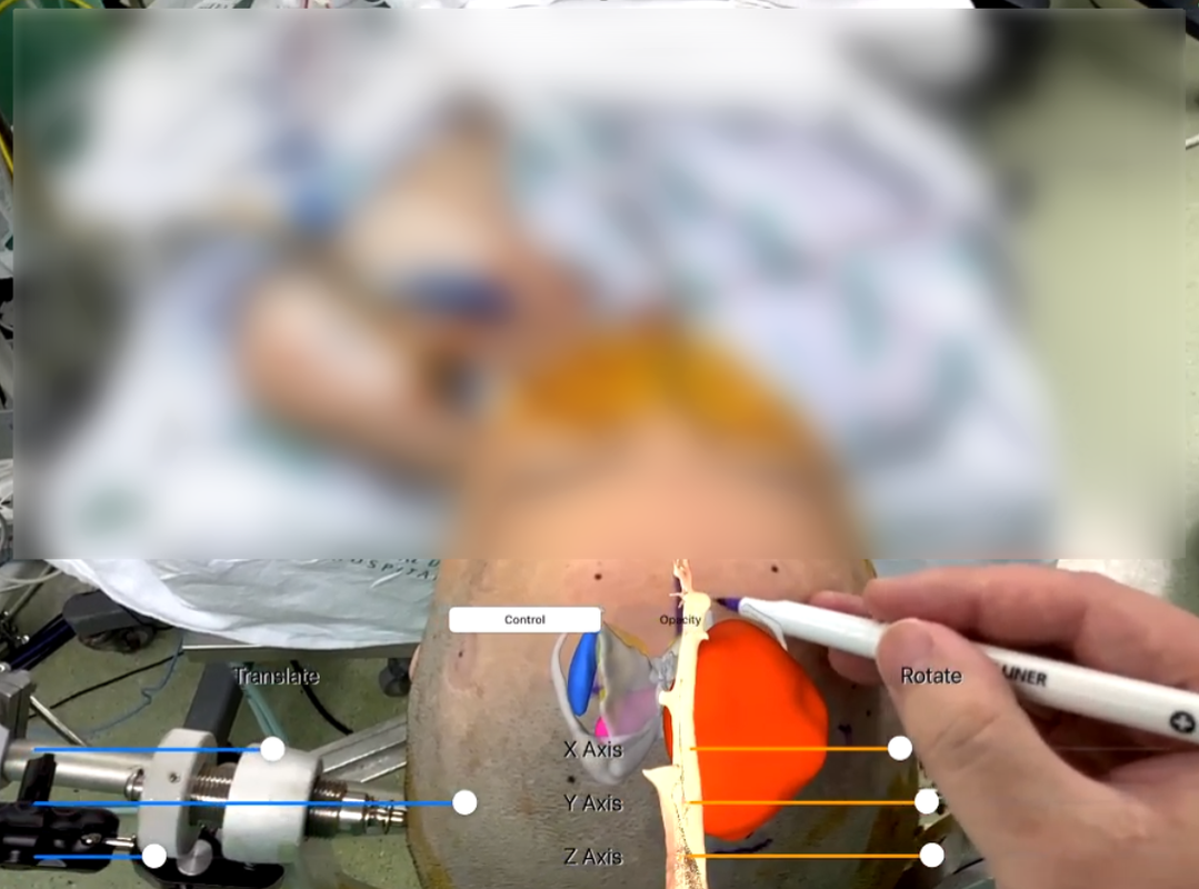 의료 증강현실(AR) 기술 구현 모습 - 메디컬아이피 제공