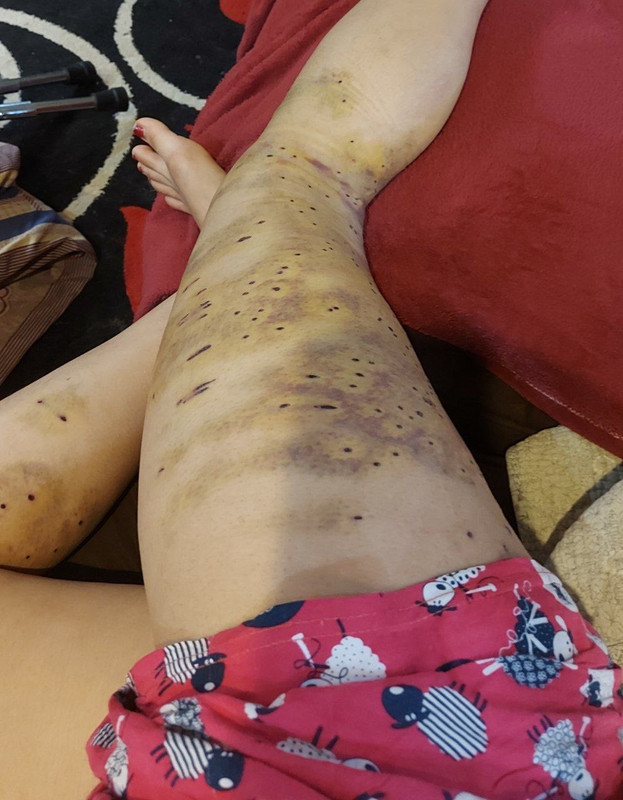 ۲۰۲۲۱۱۲۵_۱۱۳۶۲۱