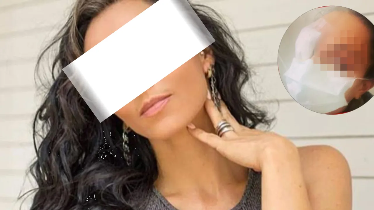 Actriz de Televisa sufre peligrosa picadura en el rostro, queda desfigurada