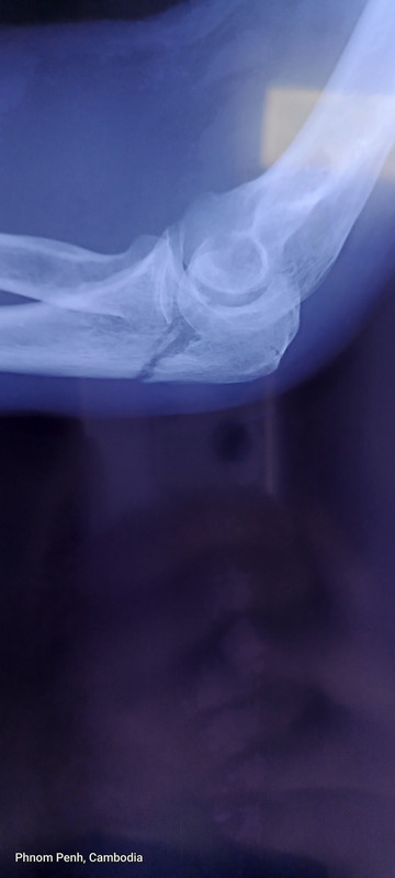 xray