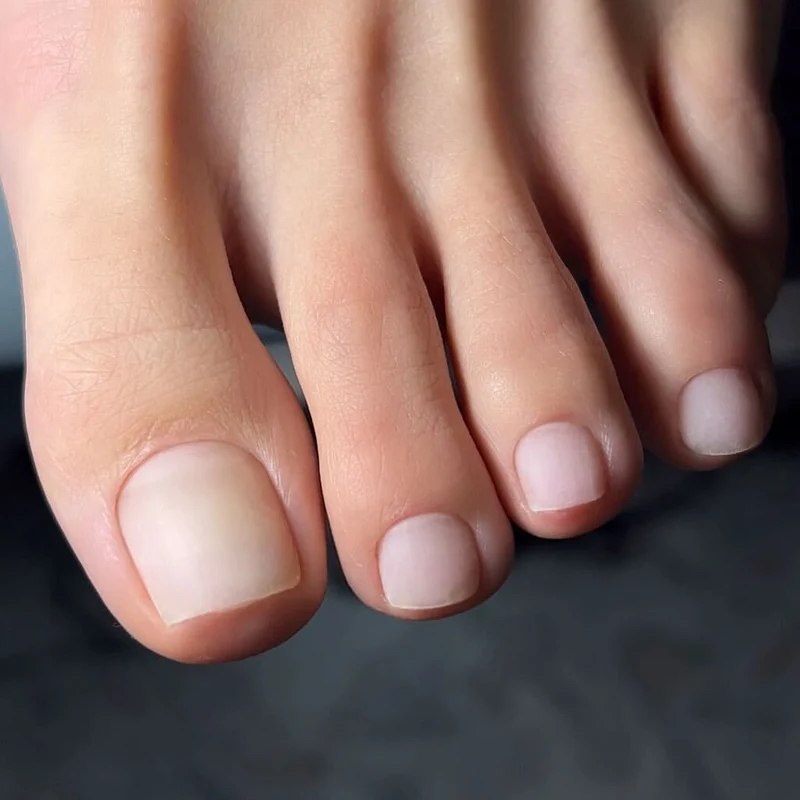 Smart Pedicure